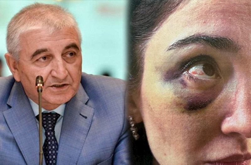 Məzahir Pənahovun oğlu arvadına işgəncə verib — Ağır ittihamlar (FOTOLAR)