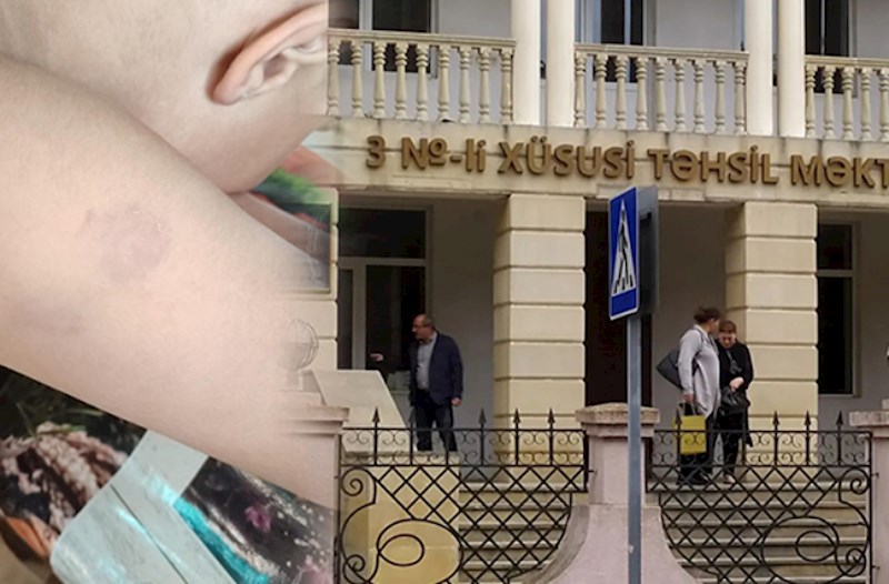 Xüsusi məktəbdə müəllim azyaşlıya şiddət göstərib? — Rəsmi açıqlama ( FOTOLAR) 