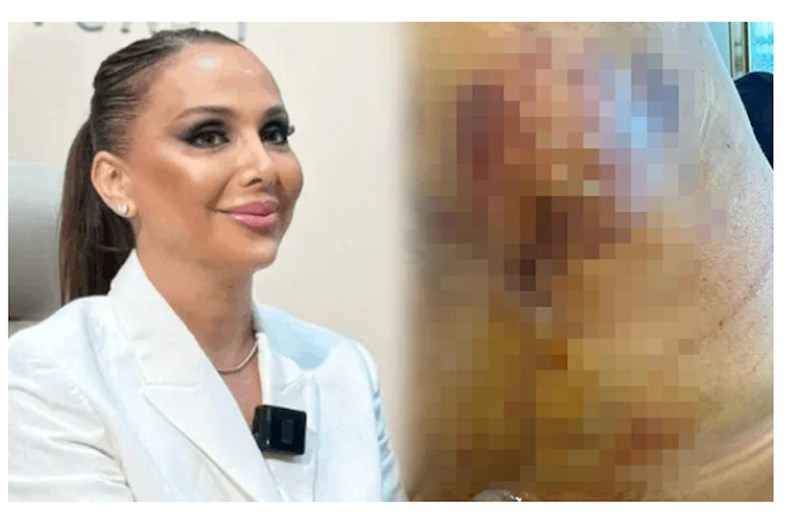 “Həkim məni 3 dəfə əməliyyat edib pis vəziyyətə qoydu” — FOTOLAR 