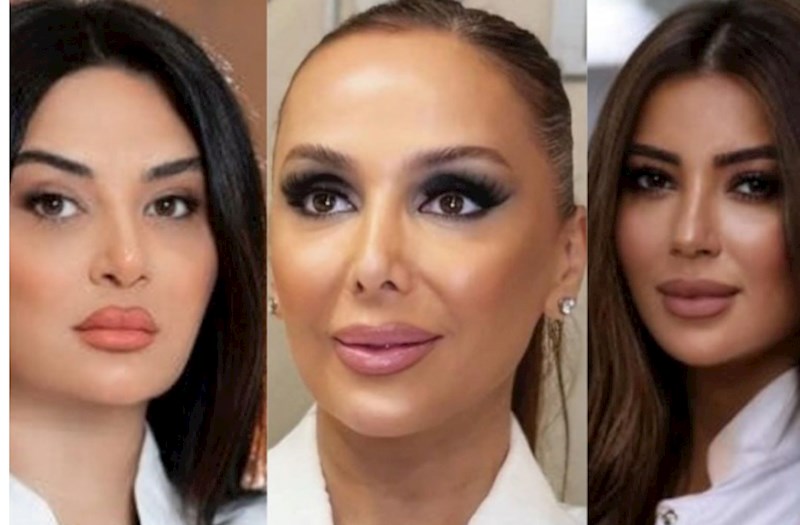 Tanınmış plastik cərrahlar qanunsuz fəaliyyət göstərir? — RƏSMİ AÇIQLAMA