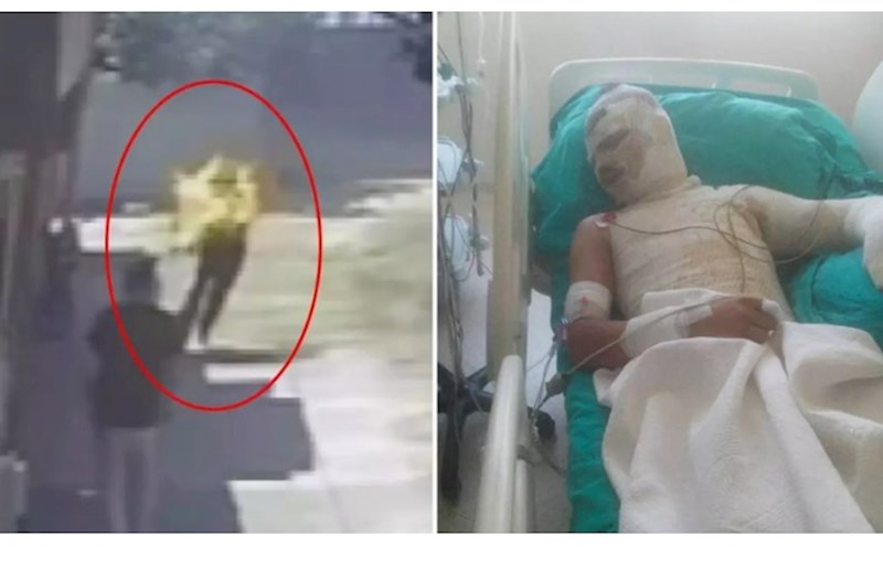 Mirasa görə qardaşı oğlunu diri-diri yandırdı — ŞOK GÖRÜNTÜLƏR 