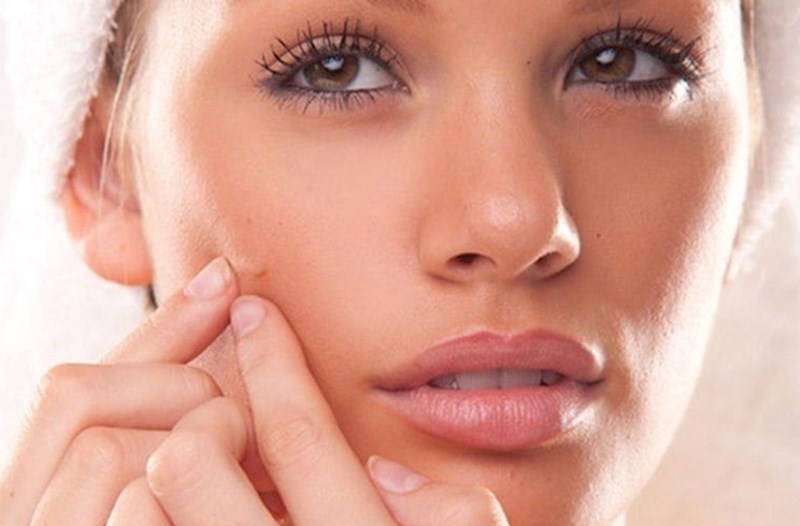 Bu qidalar üzdə sızanaq yaradır — Dermatoloqlardan xəbərdarlıq 