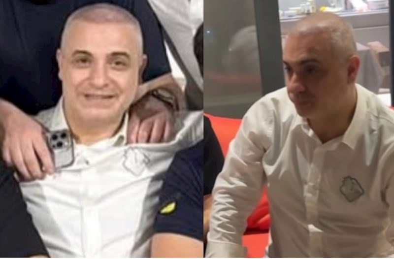 Rüfət Axundov saç əkdirib