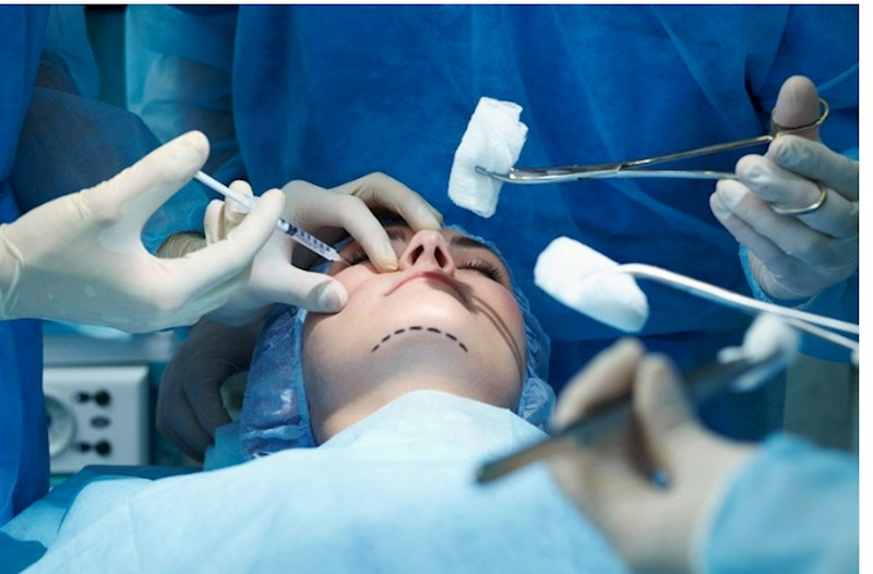 Plastik cərrahlarla bağlı 12 şikayət DAXİL OLUB — RƏSMİ 
