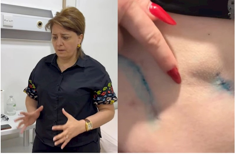 Prokurorluqda pasiyentin ölüm işində adı keçən həkim yenidən cərrahlıq edir? — VİDEO