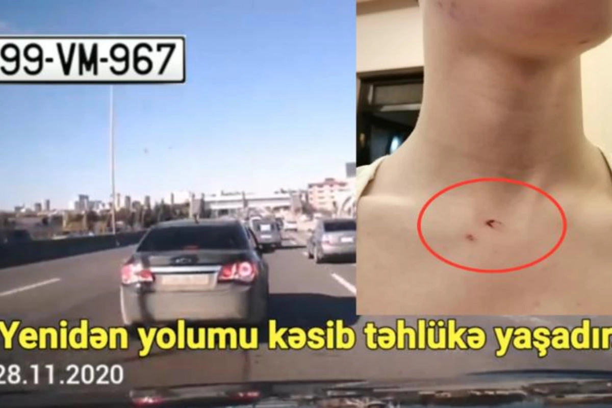 Sürücü qoçuluq edib yolu kəsdi, sonra isə azyaşlı uşağa xəsarət yetirdi —​ VİDEO