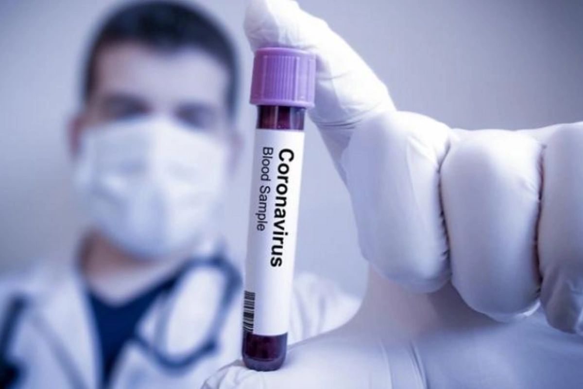 Son sutkada koronavirusa yoluxanların sayı açıqlandı