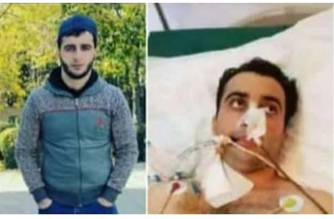 45 gün komada qalan qazimiz şəhid oldu — FOTO