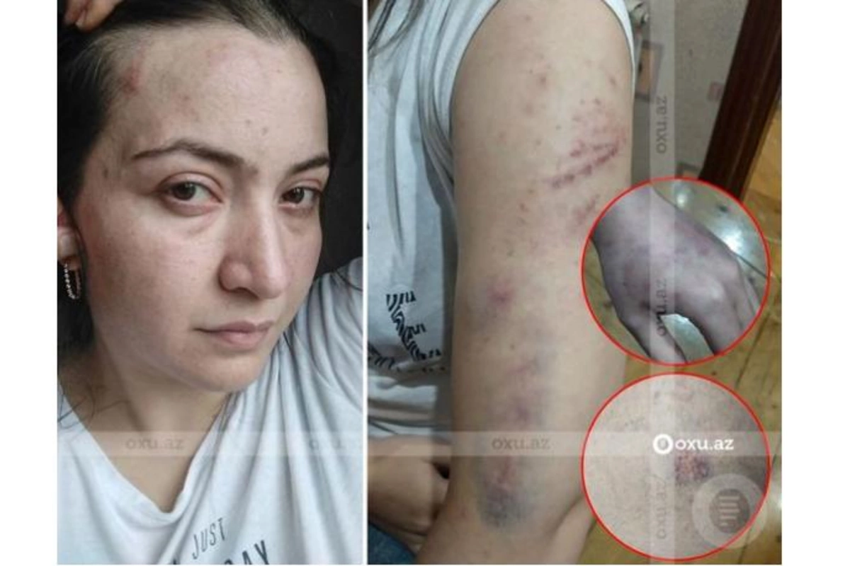Şöbədə öldürülən qadının qardaşı: Bacım yalvarıb ki, çağırmayın, mən gedim, sonra onun izahatını alarsınız...