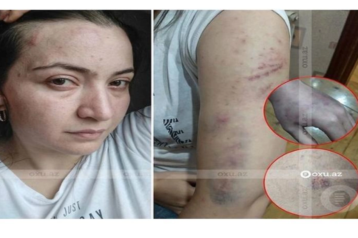 Polis bölməsində öldürülən qadının ailəsi danışdı — VİDEO