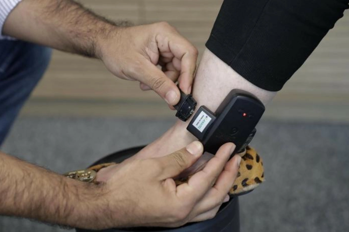 Azərbaycanda ginekoloqa elektron qolbaq taxıldı