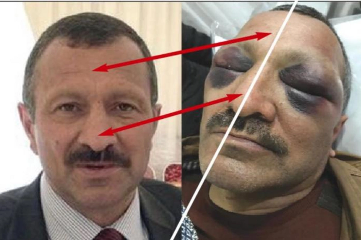 Tofiq Yaqublunu “döyən” tapıldı
