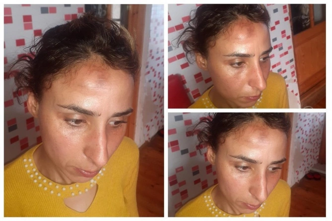 Avtobusda dava düşdü — Sərnişin döyüldü (FOTO) Avtobusda dava düşdü — Sərnişin döyüldü (FOTO)
