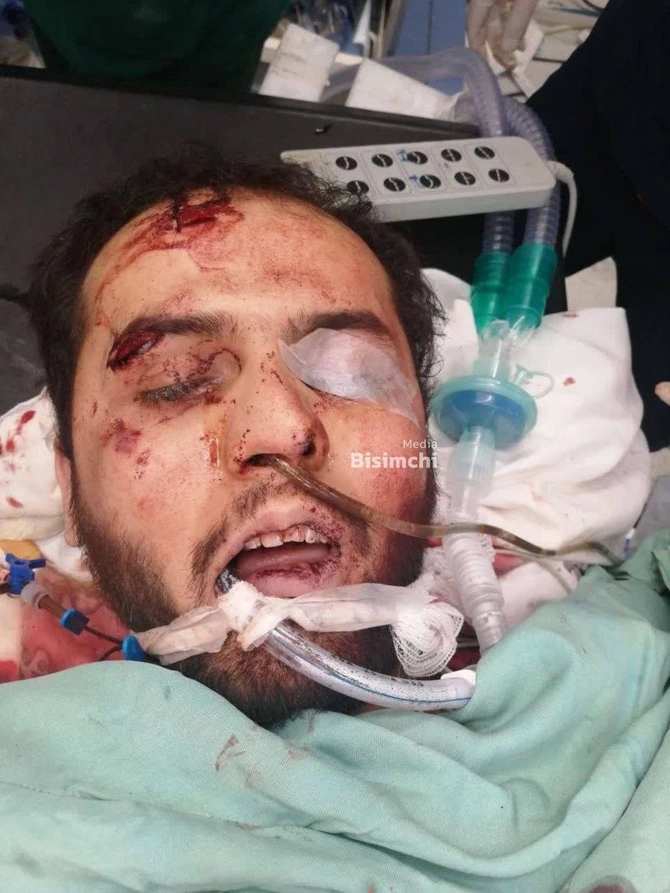 İrandakı terrorda SEPAH İZİ — FOTOFAKT