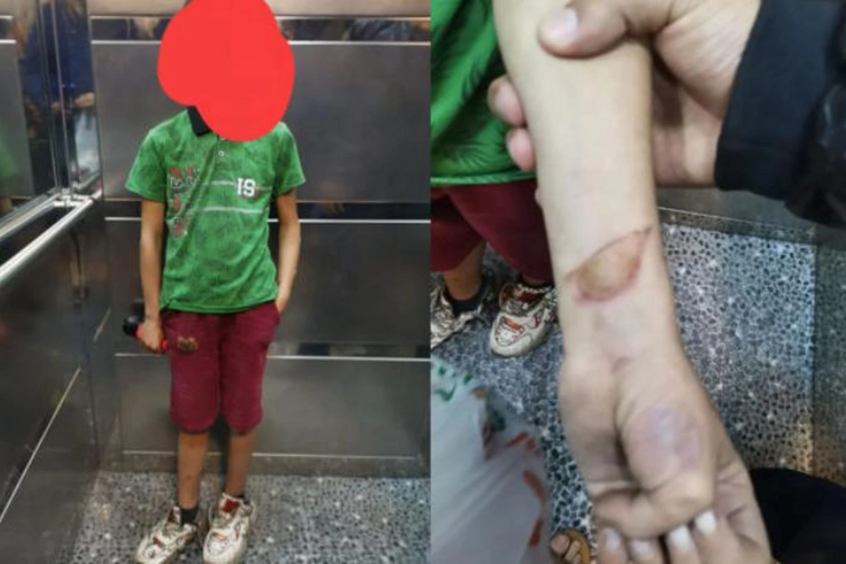 Xırdalanda ana və ata uşağa xəsarət yetirib küçəyə atıblar — FOTO