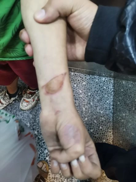Xırdalanda ana və ata uşağa xəsarət yetirib küçəyə atıblar — FOTO