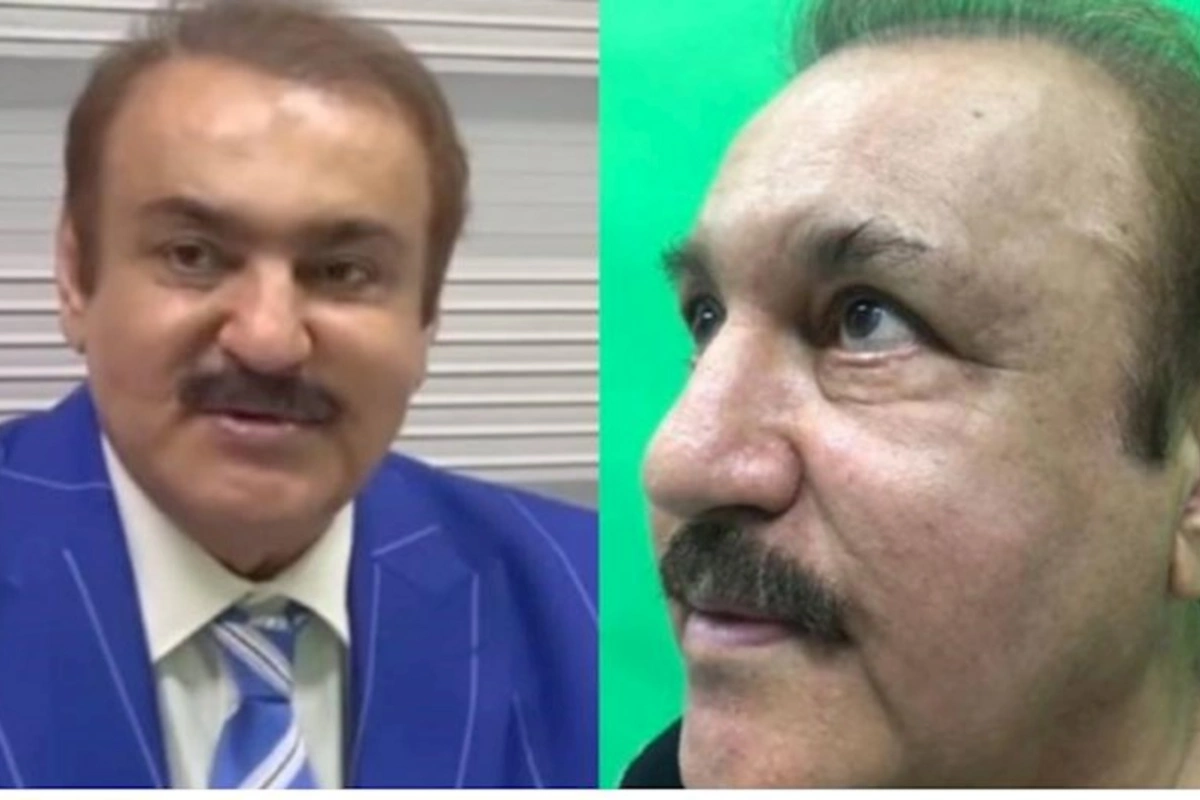 Cavanşir Məmmədov üzündə plastik əməliyyat etdirib