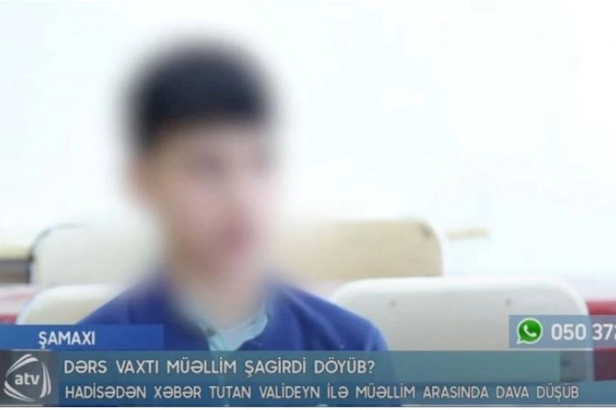 “Başımı lövhəyə, sonra tumbuçkaya vurdu” — Müəllim tərəfindən döyülən şagird danışdı (VİDEO)