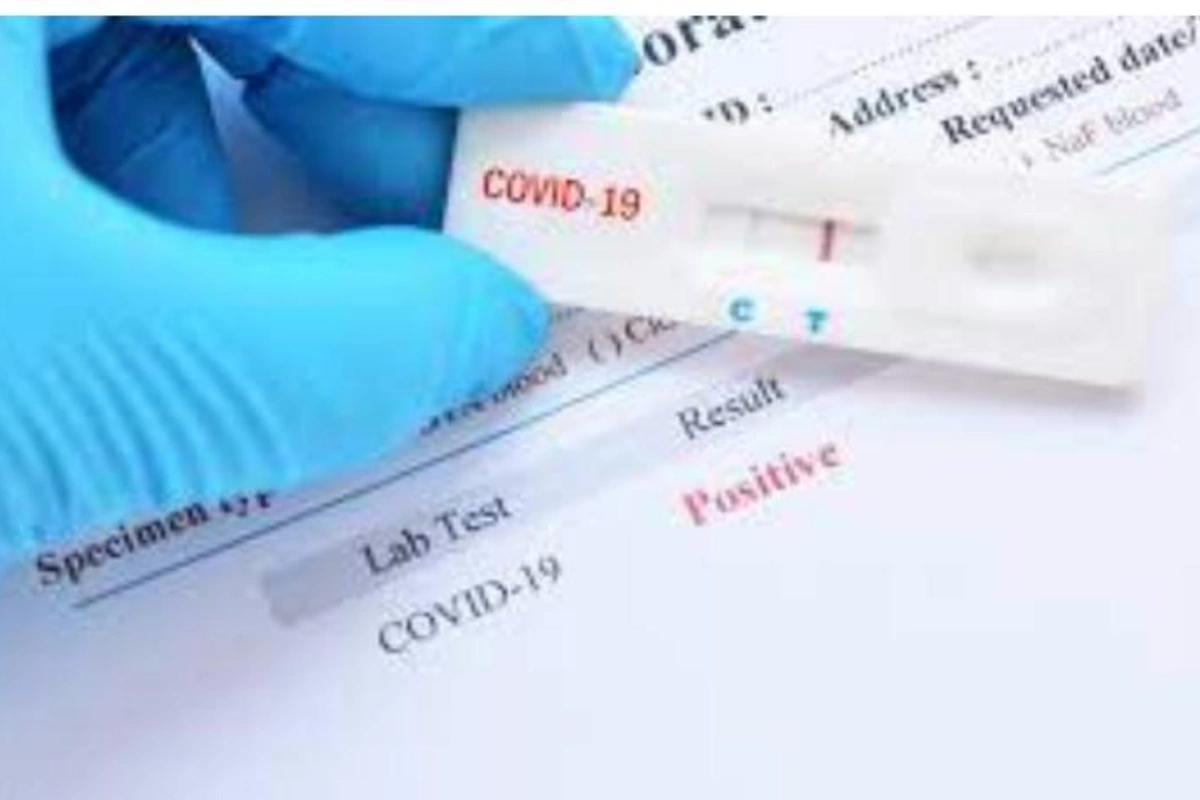 Apteklərdə satılan koronavirus testlərinin cavabları dəqiqdir? — VİDEO