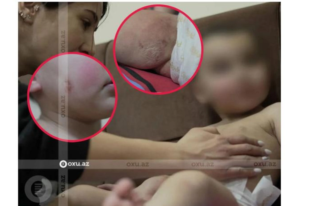Anası tərəfindən atılmış uşaq sığınacağa yerləşdirildi