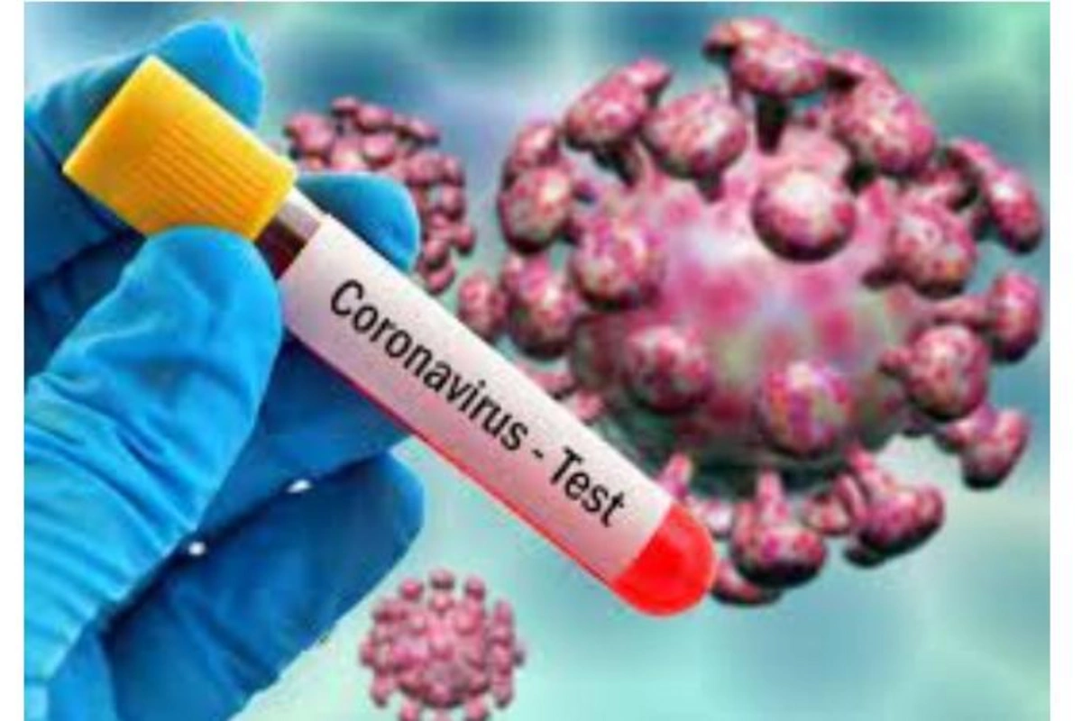 Ölkəyə qayıdanlardan koronavirus testi tələb etməyin