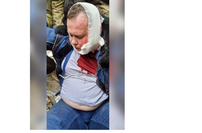 Çerniqovda vurulan Rusiya təyyarəsinin pilotu belə saxlanıldı — FOTOLAR
