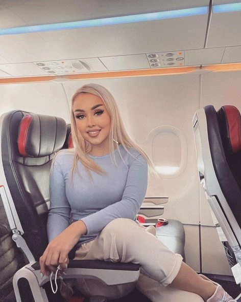Azərbaycanlı model partlayışda ağır yaralanıb — FOTOLAR