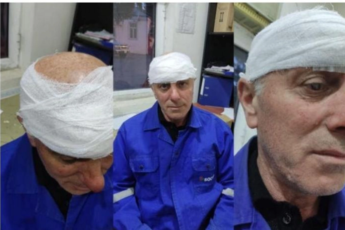 “Azəriqaz”ın işçisi döyüldü