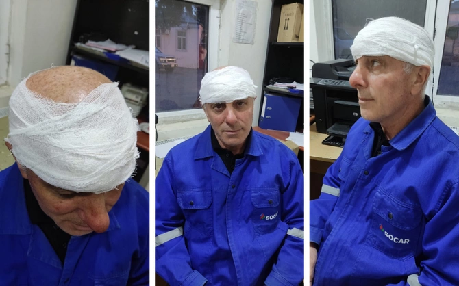“Azəriqaz”ın əməkdaşını döyən şəxs həbs olundu