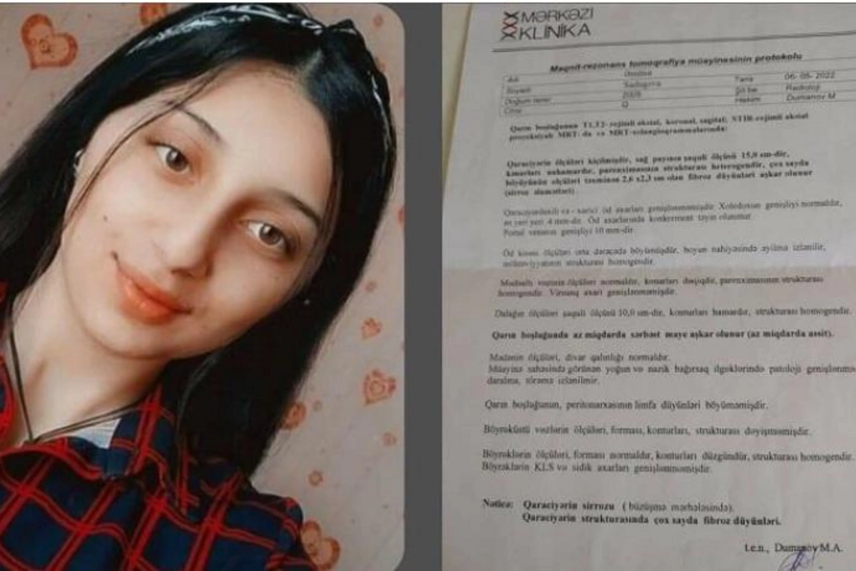 17 yaşlı Əminəyə təcili qaraciyər köçürülməlidir — FOTO
