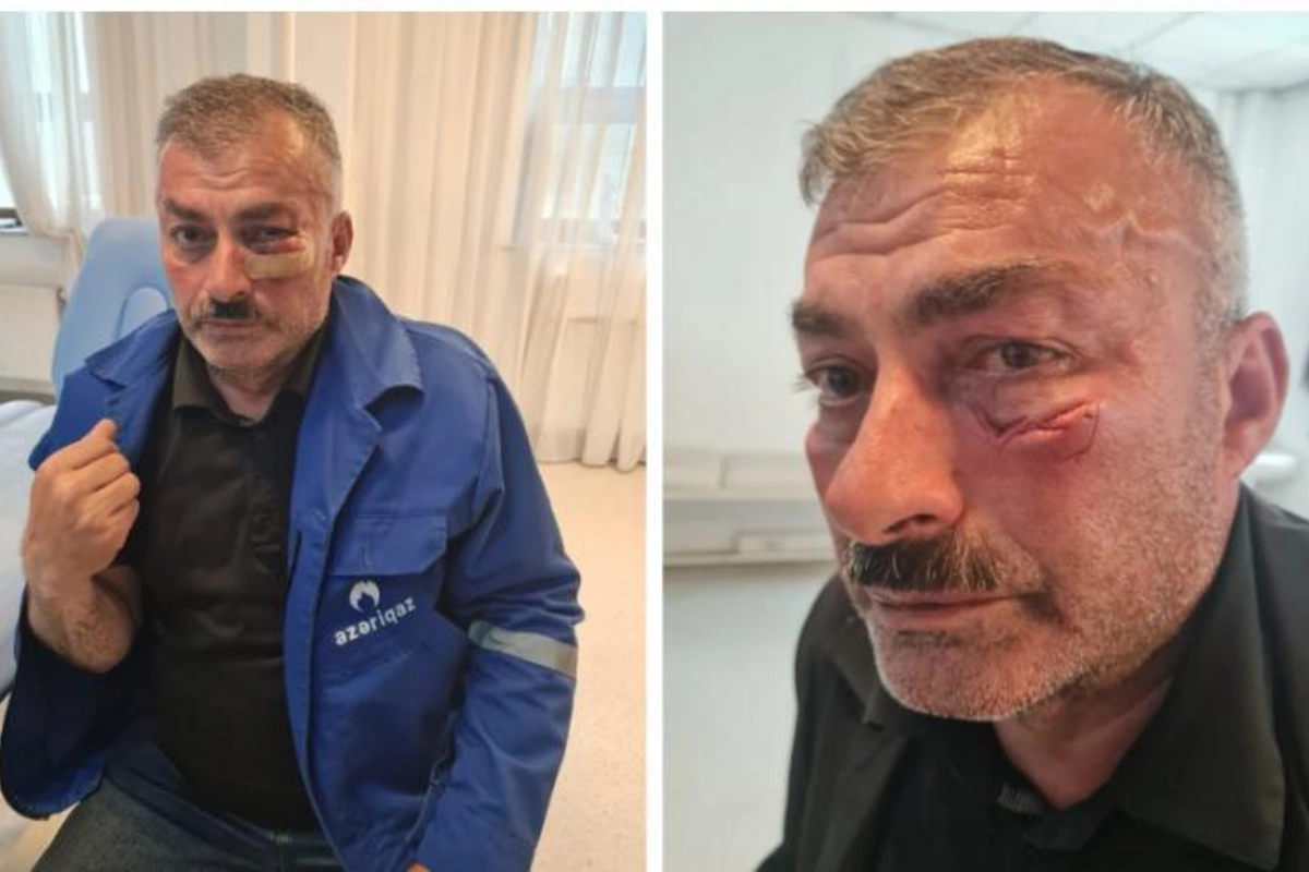 “Azəriqaz”ın əməkdaşına qarşı zor tətbiqi ilə bağlı cinayət işi başlandı
