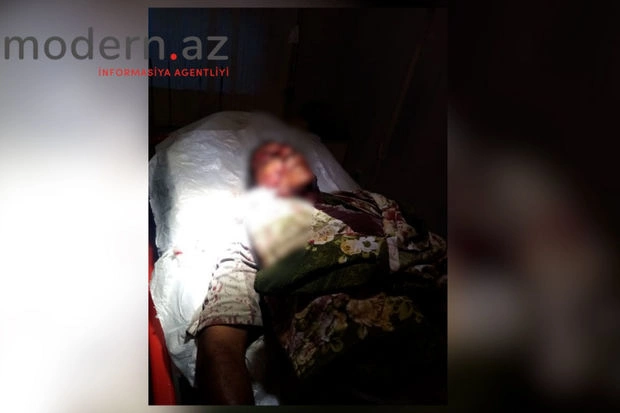Ağsuda canavar çobana hücum etdi — FOTO Ağsuda canavar çobana hücum etdi — FOTO