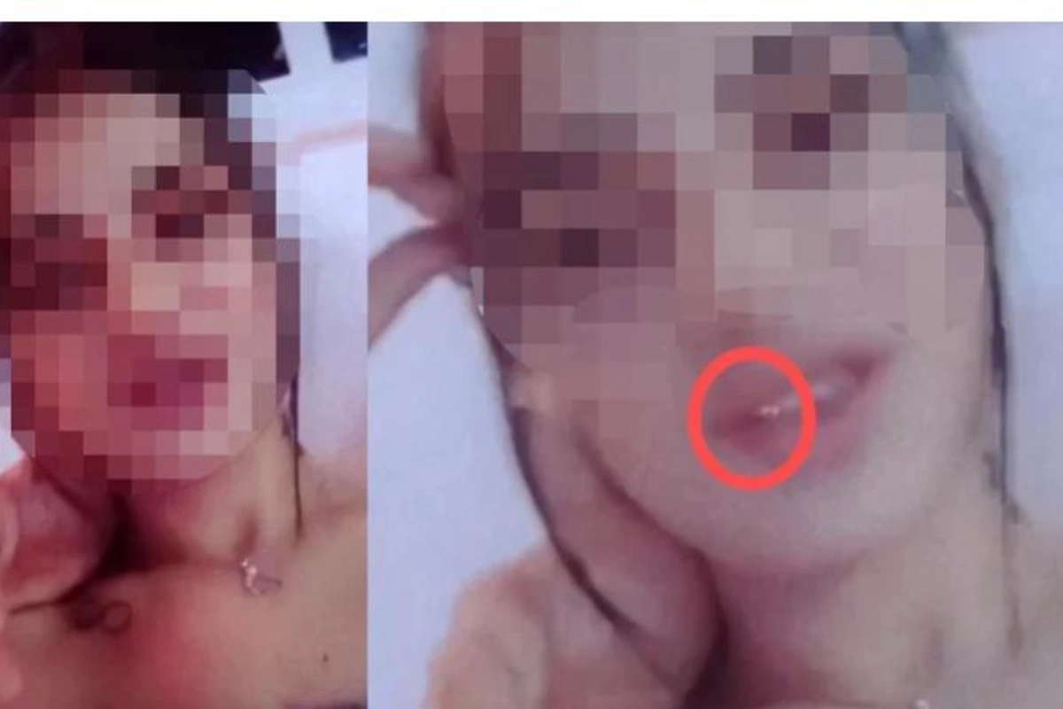 Polis azərbaycanlı prokuror qadına görə qızıl diş əməliyyatı keçirdi - VİDEO
