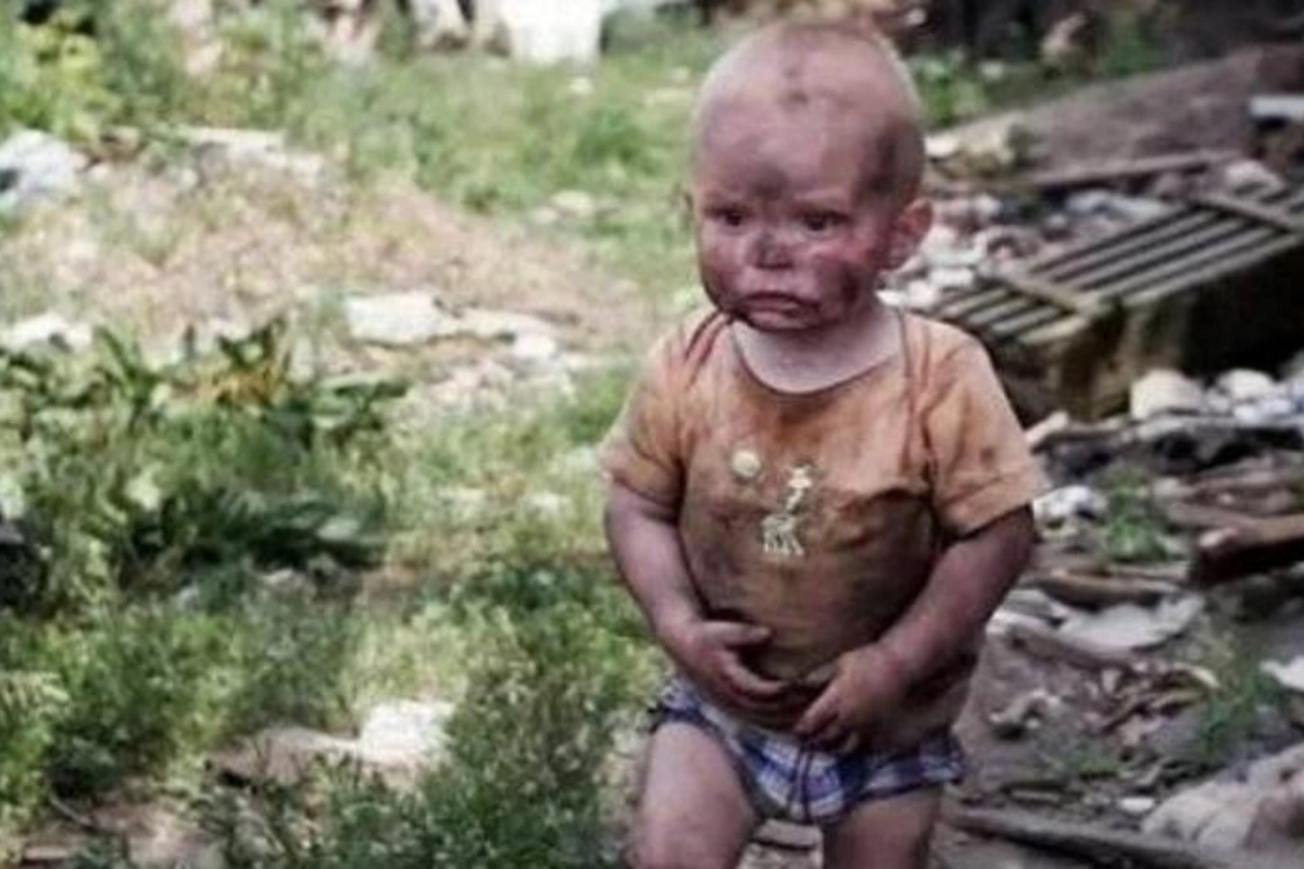 Ukraynada yaralanan uşaqların sayı 600-ü keçdi
