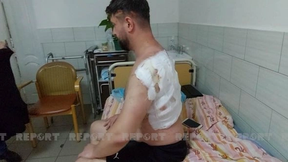Vinnitsada azərbaycanlıların da mülkləri dağılıb, son statistika açıqlanıb — FOTO