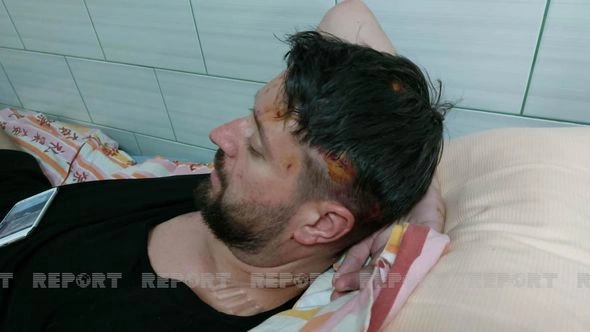Vinnitsada azərbaycanlıların da mülkləri dağılıb, son statistika açıqlanıb — FOTO