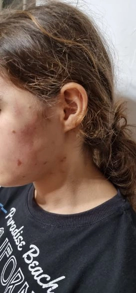 Lənkəranda icra başçısının müavini yeniyetmə qızı vəhşicəsinə döyüb — İDDİA (FOTO)