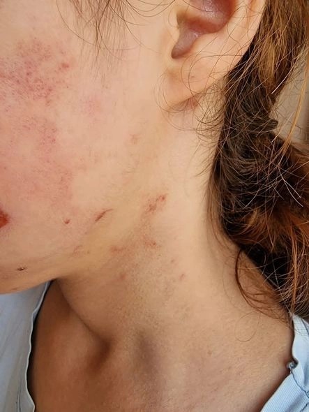 Lənkəranda icra başçısının müavini yeniyetmə qızı vəhşicəsinə döyüb — İDDİA (FOTO)