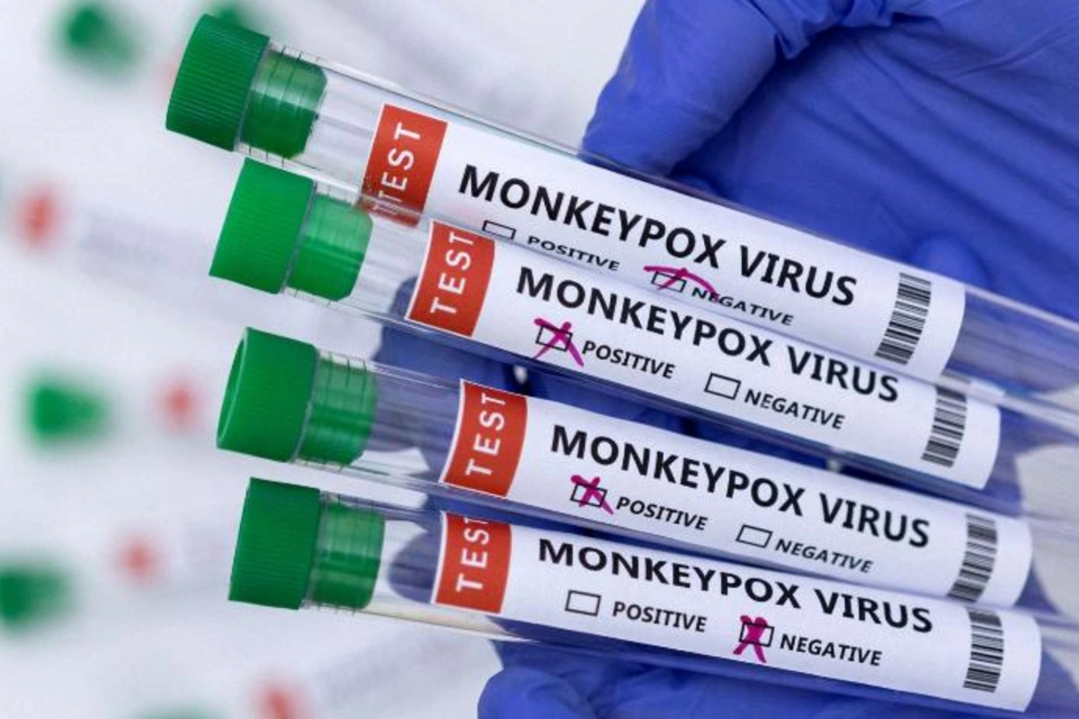 Nigeriyada meymunçiçəyi virusuna yoluxanların sayı 39-a çatıb