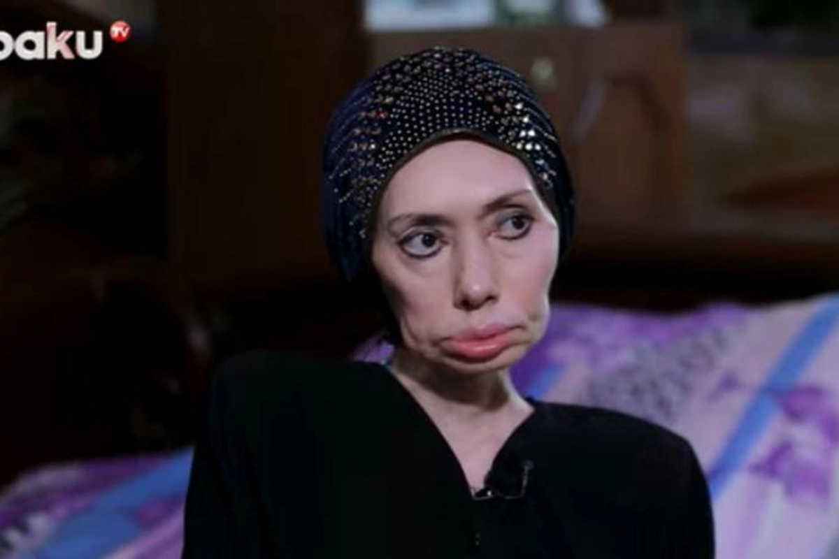 Ayna Sultanovanın nəticəsi: “Erməni tibb bacısı məni əlil etdi” — VİDEO
