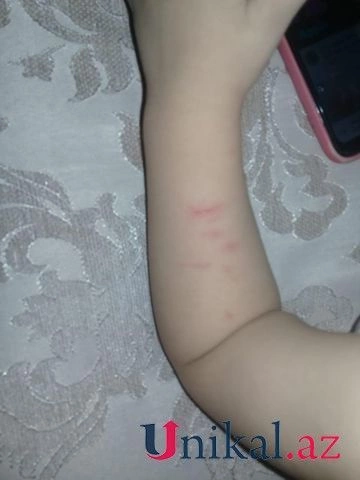 Bir yaşlı uşaq bağçada döyülüb? — FOTO