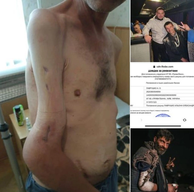 4 ay Rusiya əsirliyi “Azov döyüşçüsü”nü tanınmaz hala saldı — FOTO