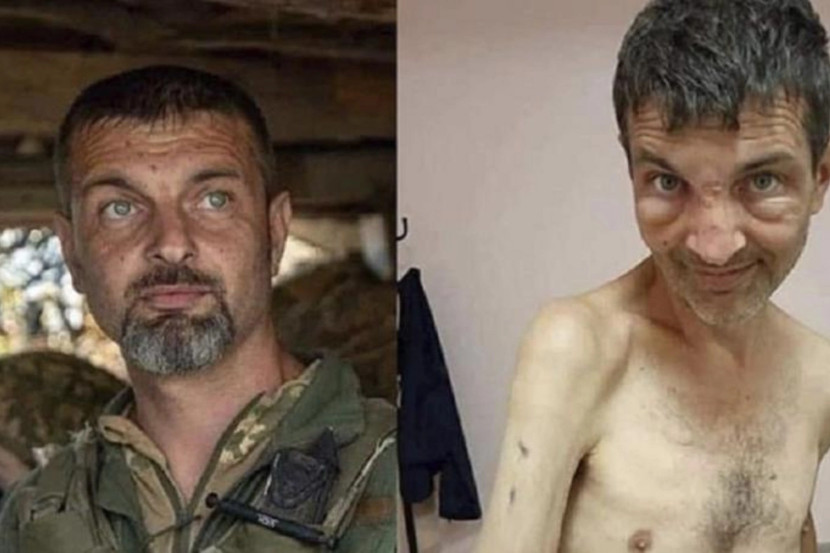4 ay Rusiya əsirliyi “Azov döyüşçüsü”nü tanınmaz hala saldı — FOTO