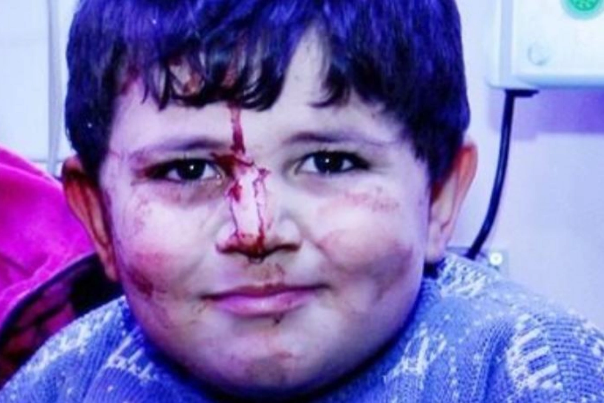 “Məni Polad Həşimova bənzədirlər, bununla fəxr edirəm” — Gəncənin 6 yaşlı qəhrəmanı Bəxtiyar (VİDEO)