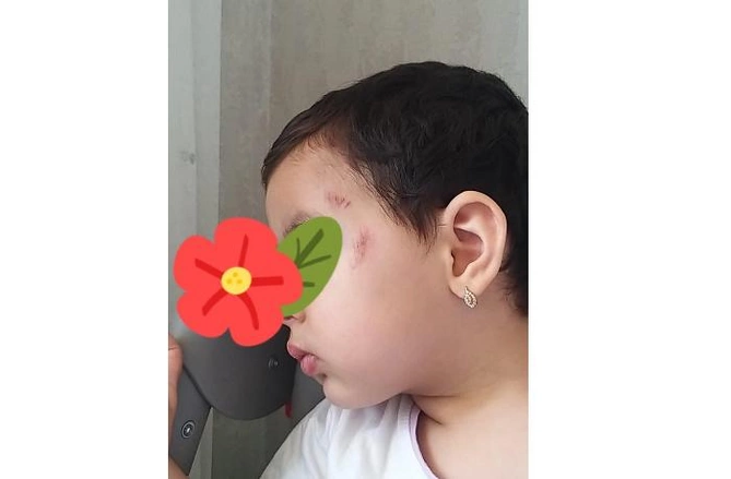 Azərbaycanda daha bir baxçada dəhşətli hadisə — Bağça rəhbərliyi isə kamera görüntülərini təqdim etməkdən yayınır (FOTOFAKT)