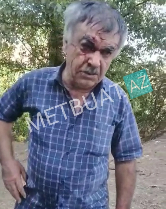 Lerikdəki qəzada ölən qadınların FOTOSU