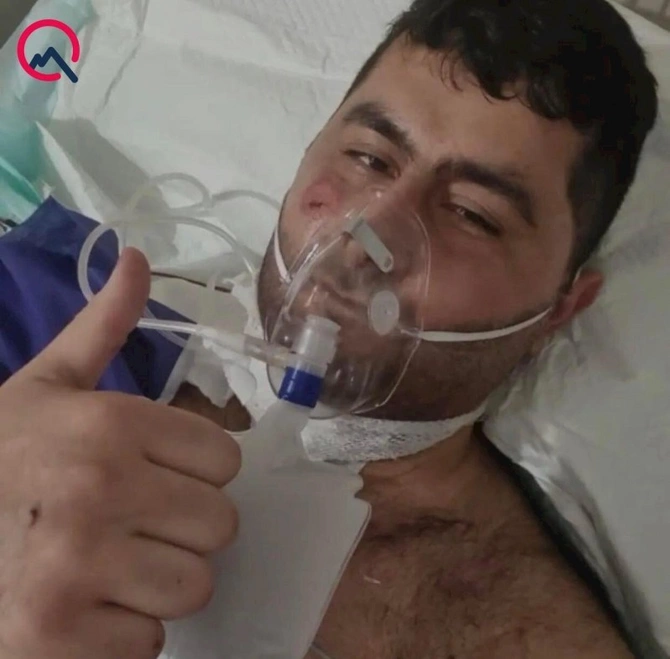 Terrorçunu zərərsizləşdirən Vasifin əməliyyatdan sonrakı FOTOSU