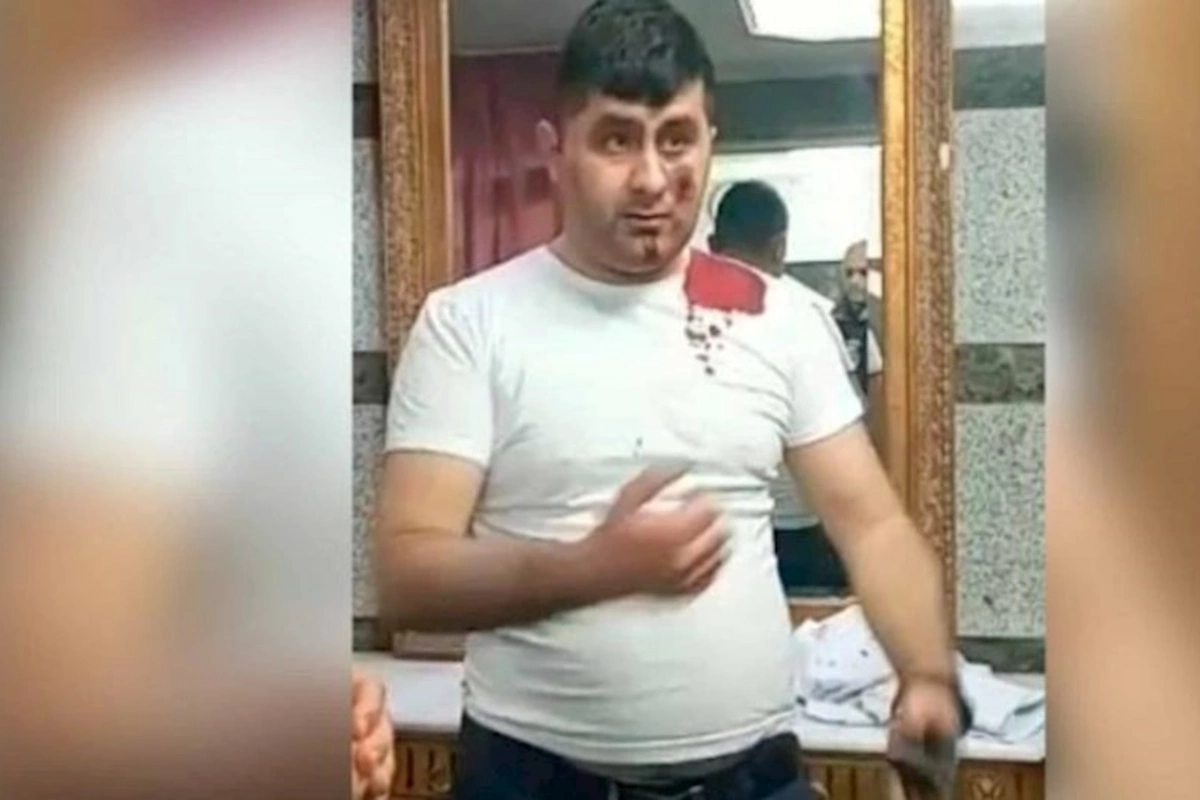 Terrorçunu zərərsizləşdirən Vasifin əməliyyatdan sonrakı FOTOSU