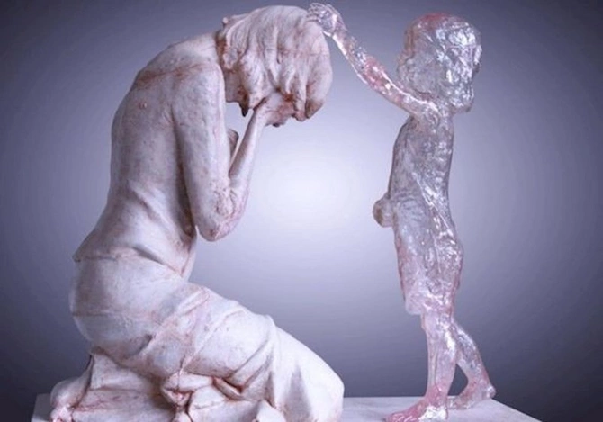 Selektiv abortların qarşısı necə alınmalıdır? — ARAŞDIRMA Selektiv abortların qarşısı necə alınmalıdır? — ARAŞDIRMA