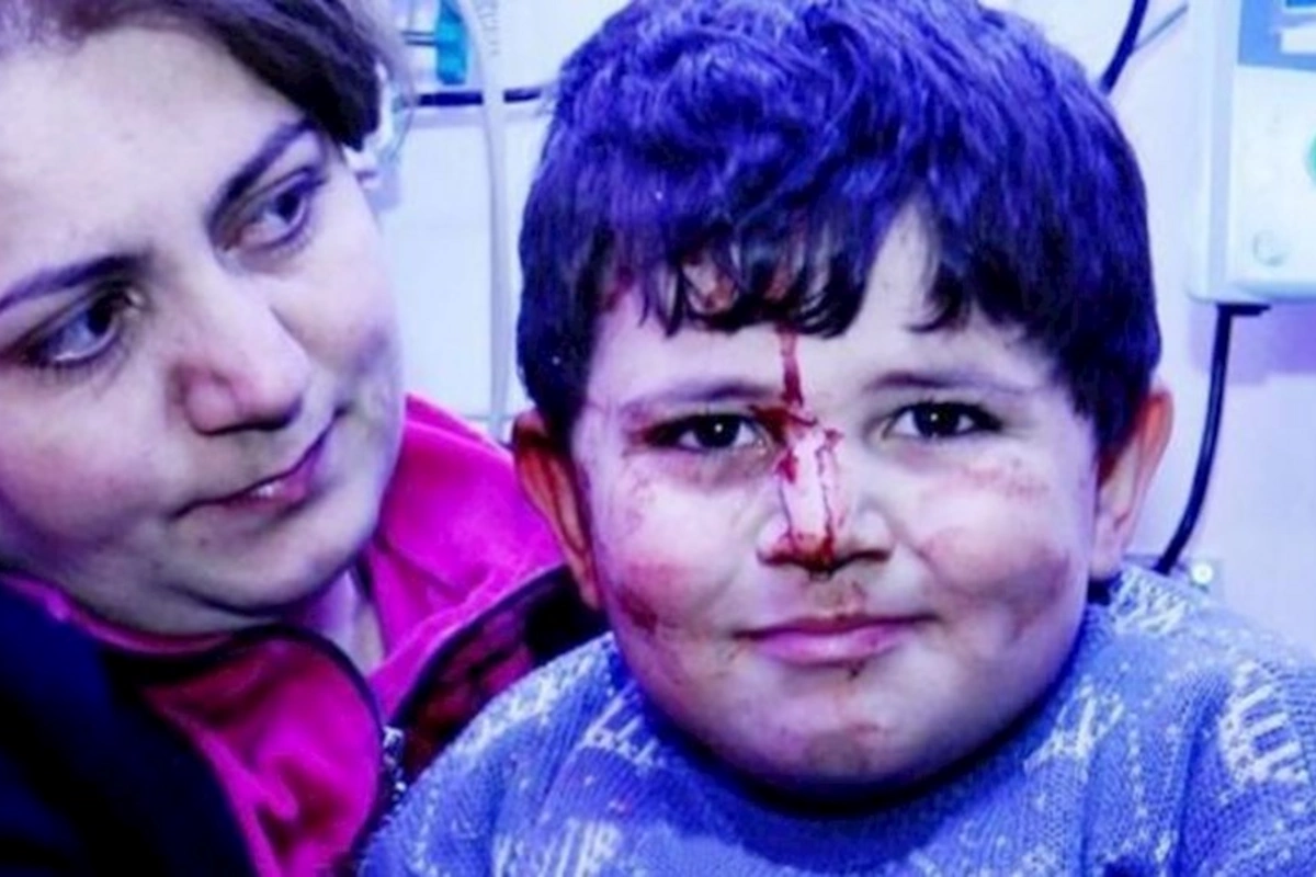Gəncə terrorunun canlı şahidləri: Balaca Bəxtiyar 3 il sonra — VİDEO
